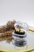 Kovinske kroglice Zlate kroglice (2*24 g)
